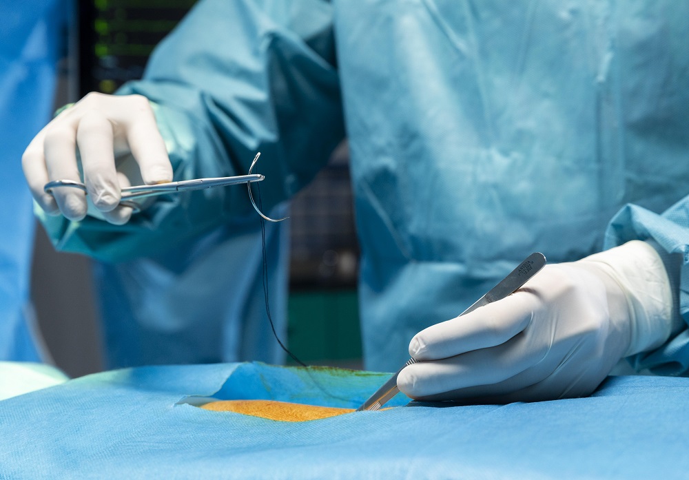 Chromic Catgut vs. Synthetic Sutures: Understanding the Core Differences